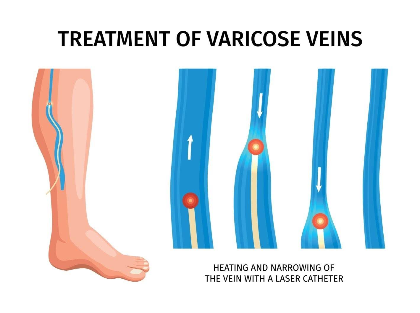 Procedure Image