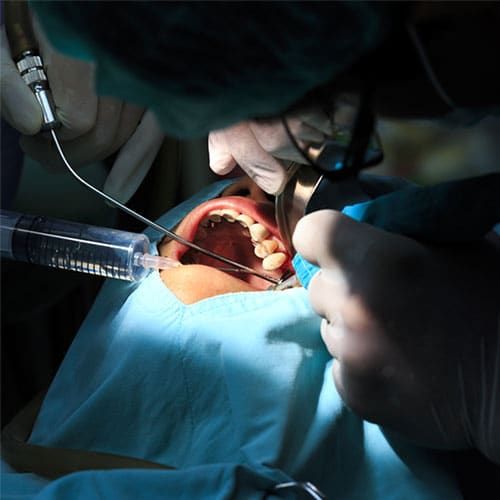Procedure Image