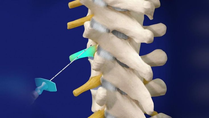 Procedure Image