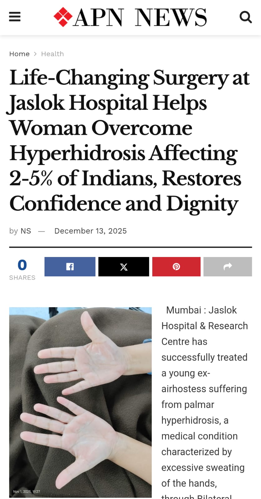 Life-Changing Surgery at Jaslok Hospital Helps Woman Overcome Hyperhidrosis Affecting 2-5% of Indians, Restores Confidence and Dignity