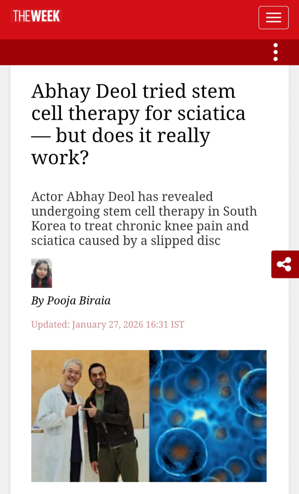 Abhay Deol tried stem cell therapy for sciatica — but does it really work?