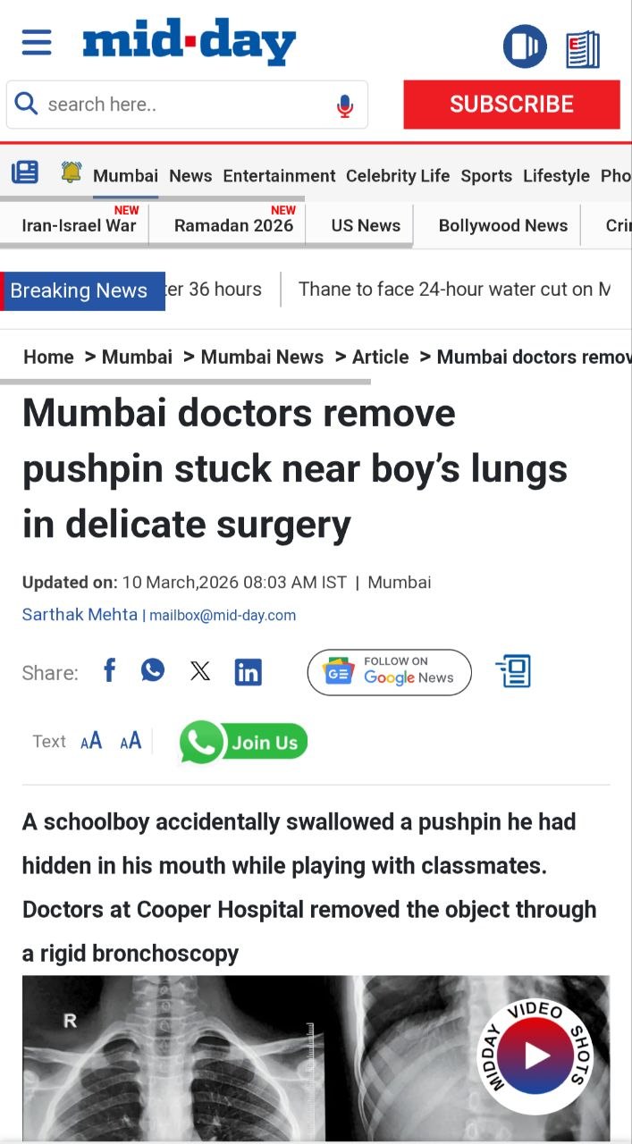 Mumbai doctors remove pushpin stuck near boy’s lungs in delicate surgery