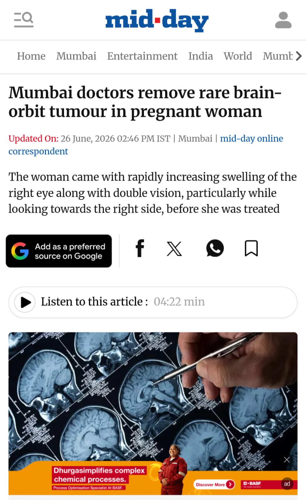 Mumbai doctors remove rare brain-orbit tumour in pregnant woman